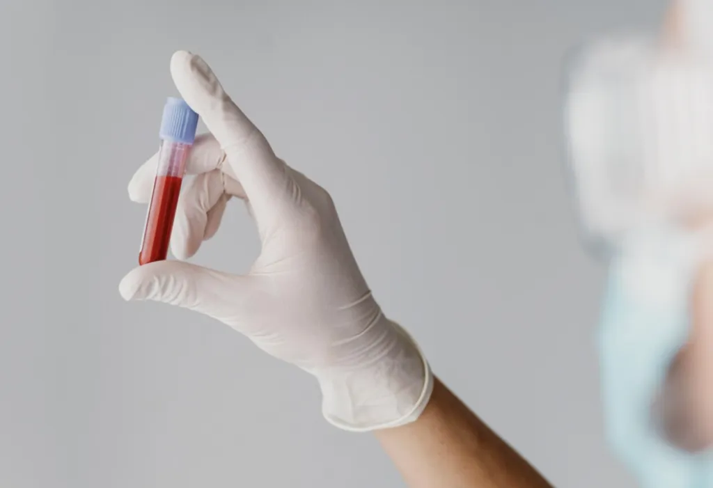 El 01 de diciembre se conmemora el Día Mundial del SIDA.