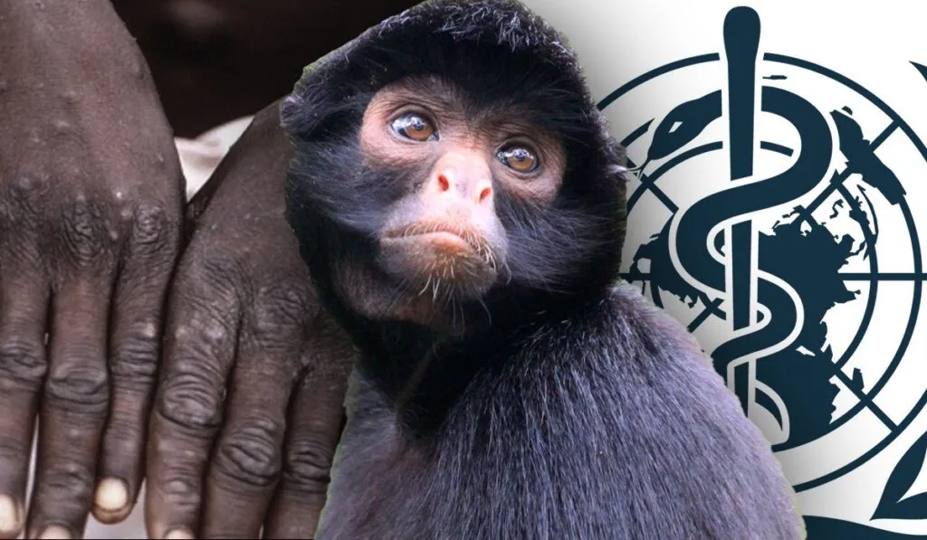 OMS declara emergencia internacional por el Mpox o viruela del mono